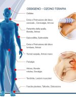 illustrazione benedici ozonoterapia