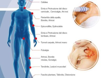 illustrazione benedici ozonoterapia