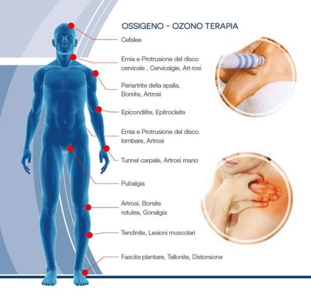 illustrazione benedici ozonoterapia