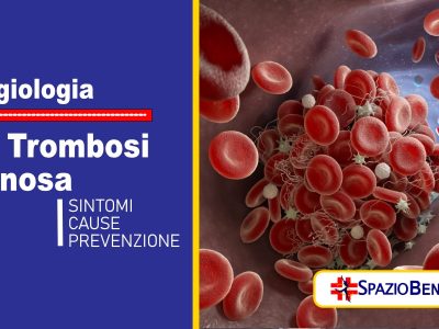 La Trombosi Venosa: Sintomi e cause