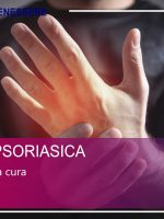 Artrite Psoriasica - dalla cura alla diagnosi