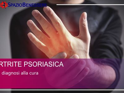 Artrite Psoriasica - dalla cura alla diagnosi