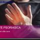 Artrite Psoriasica - dalla cura alla diagnosi