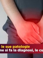 La prostata e le sue patologie