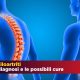 Spondiloartrite: i tipi, le cause, la diagnosi, le cure