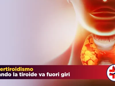 Ipertiroidismo: quando la tiroide è iperattiva