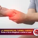 La sindrome del tunnel carpale: dalla diagnosi alle cure