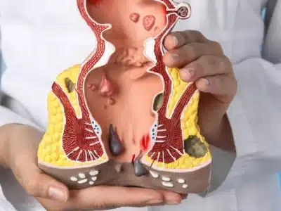 visite specialistiche proctologia