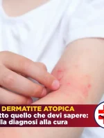 La dermatite atopica: Ragazza con prurito