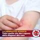 La dermatite atopica: Ragazza con prurito