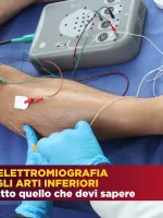 Elettromiografia Arti Inferiori