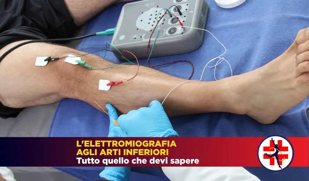 Elettromiografia Arti Inferiori