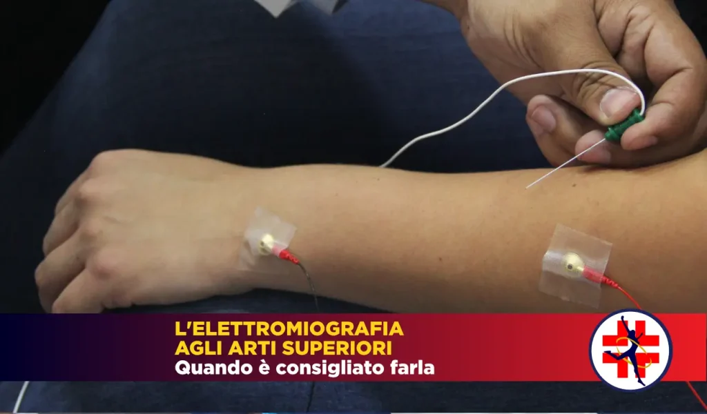 Elettromiografia arti superiori