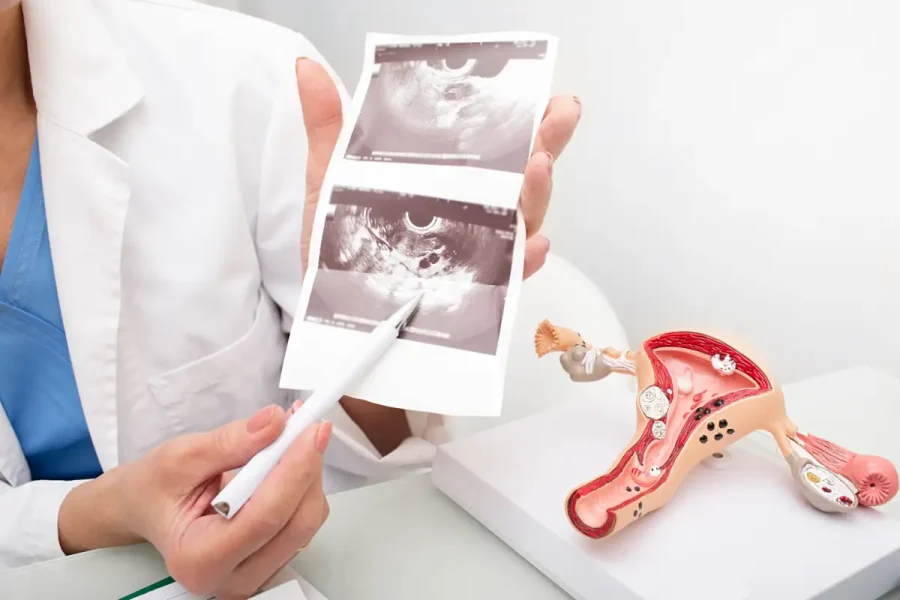 Referto di un'ecografia transvaginale