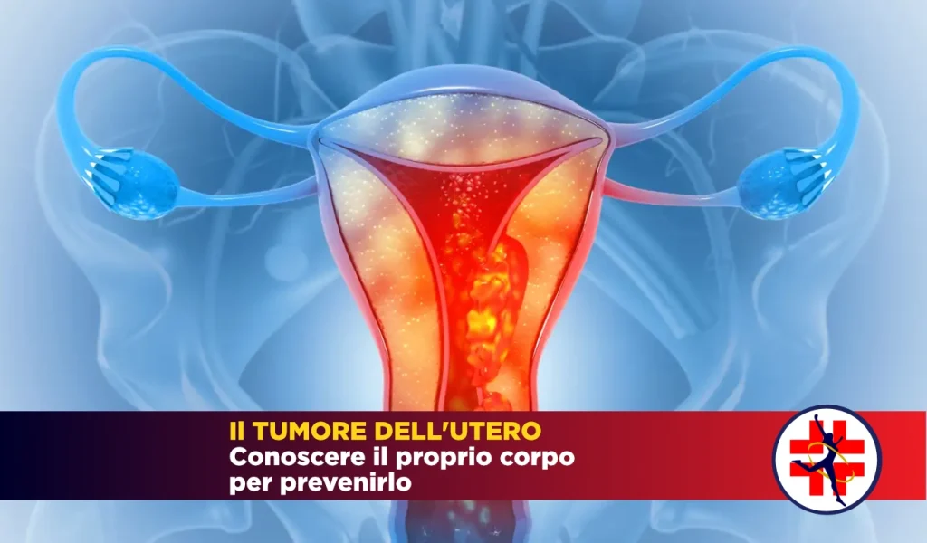 Tumore utero
