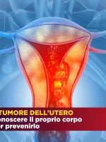 Tumore utero