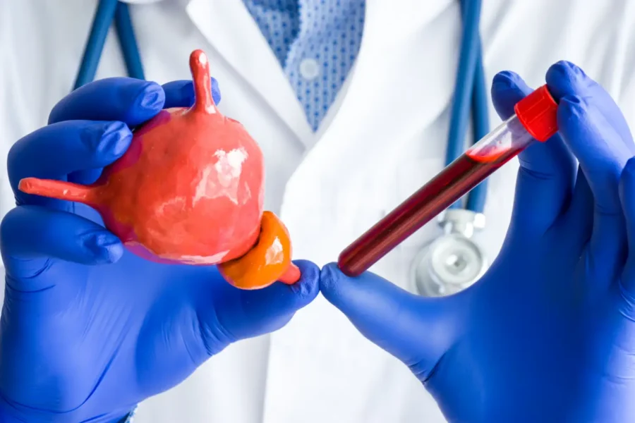 PSA Test e patologie alla prostata