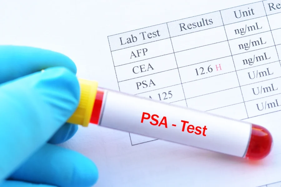 Risultati PSA test
