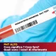 PHT Alto: esame del sangue