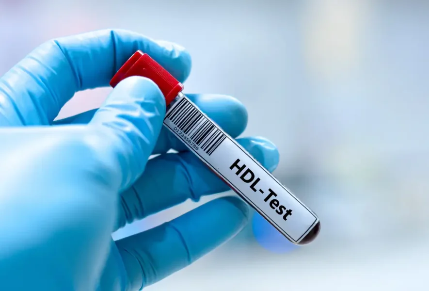 Esami del sangue colesterolo alto
