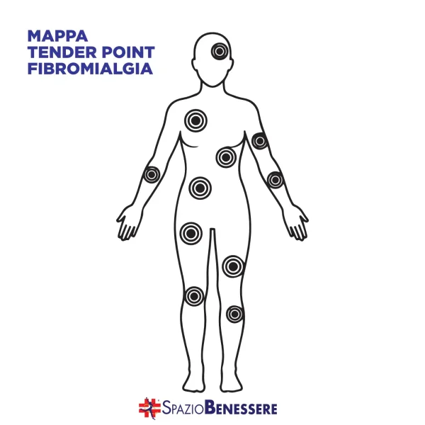 tender point fibromialgia: mappa